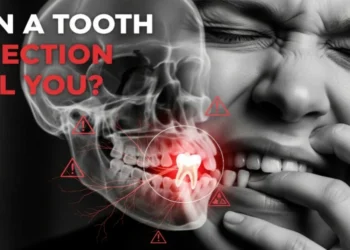 Can You Die from a Tooth Infection? Warning Signs, Risks, and Prevention.