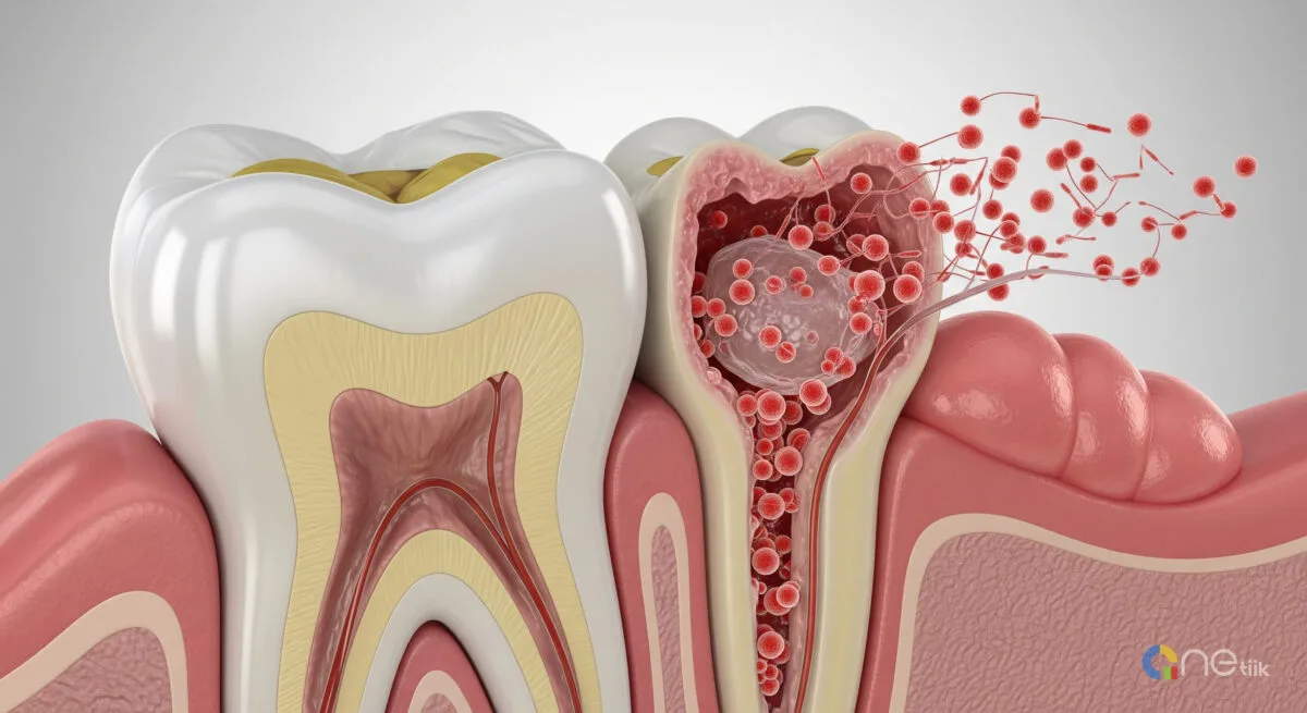 Can You Die from a Tooth Infection? Warning Signs, Risks, and Prevention.